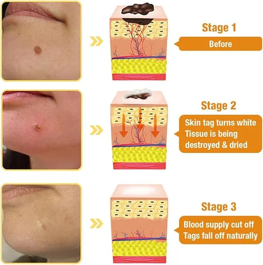 Dermasia Skin Lightening Blemish Cream 50g