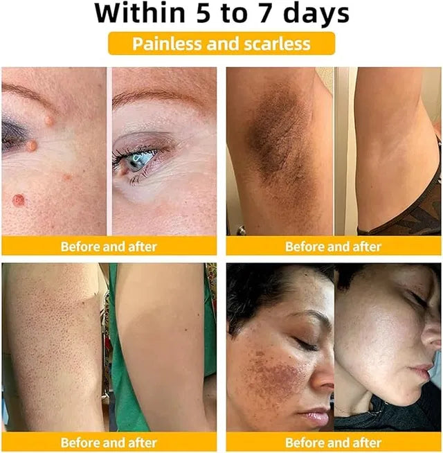 Dermasia Skin Lightening Blemish Cream 50g